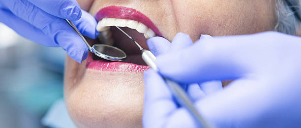 Best Emergency TMJ Treatment in Perry Park, CO